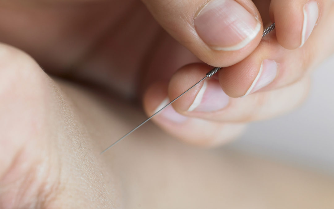 ACUPUNCTURISTS VS. MEDICAL DOCTORS PRACTICING ACUPUNCTURE VS PHYSICAL THERAPISTS PRACTICING DRY NEEDLING